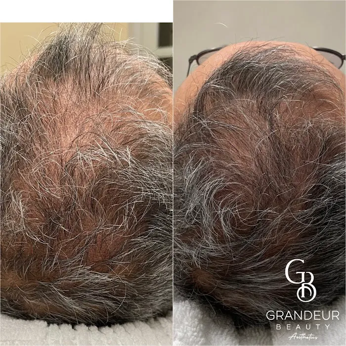 Grandeur Beauty Aesthetics Picture 9