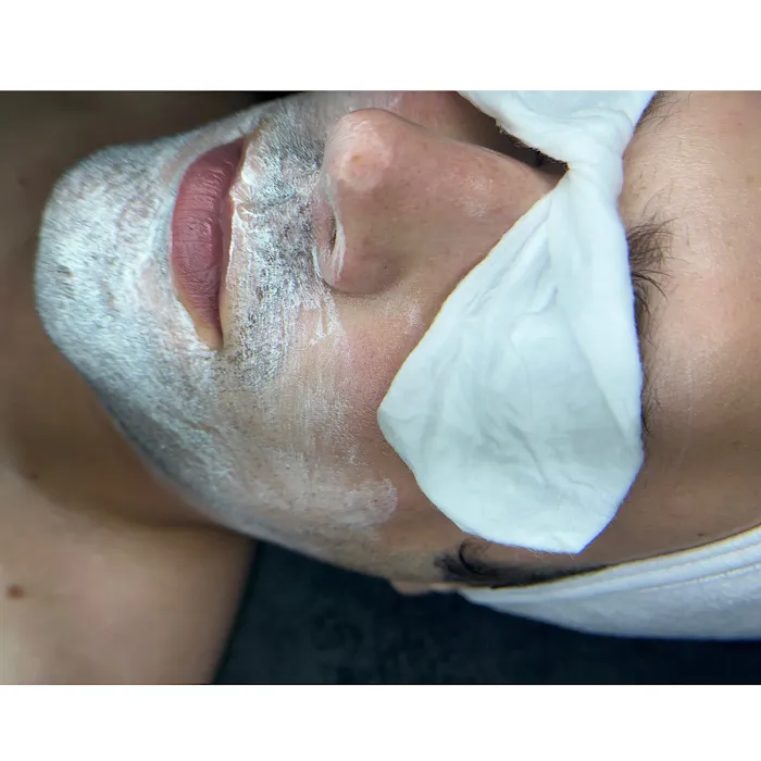 Kima Aesthetics Picture 10