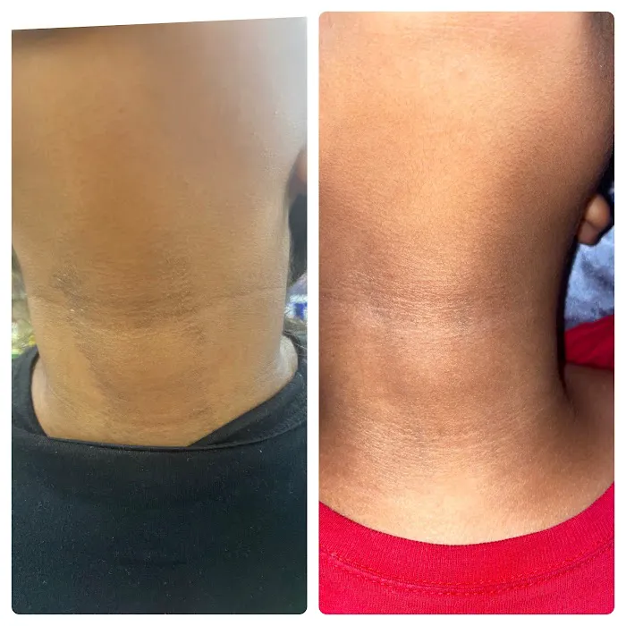 Satin Finish Skin Picture 5