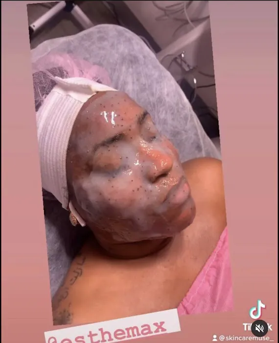 SkinCare Muse Picture 4