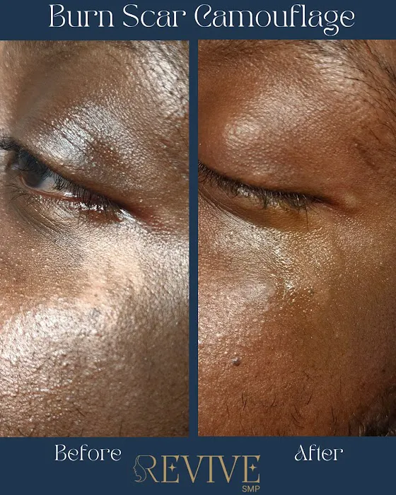 Revive SMP LLC Picture 1