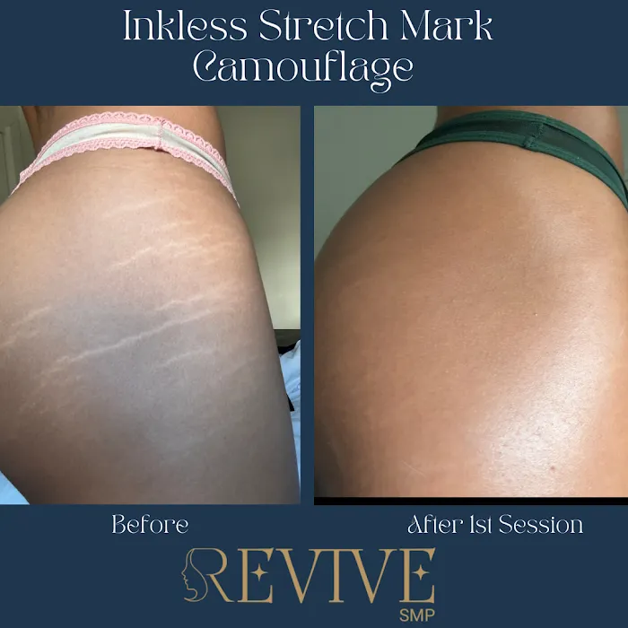 Revive SMP LLC Picture 3