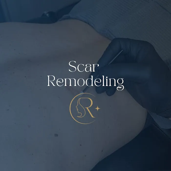 Revive SMP LLC Picture 4