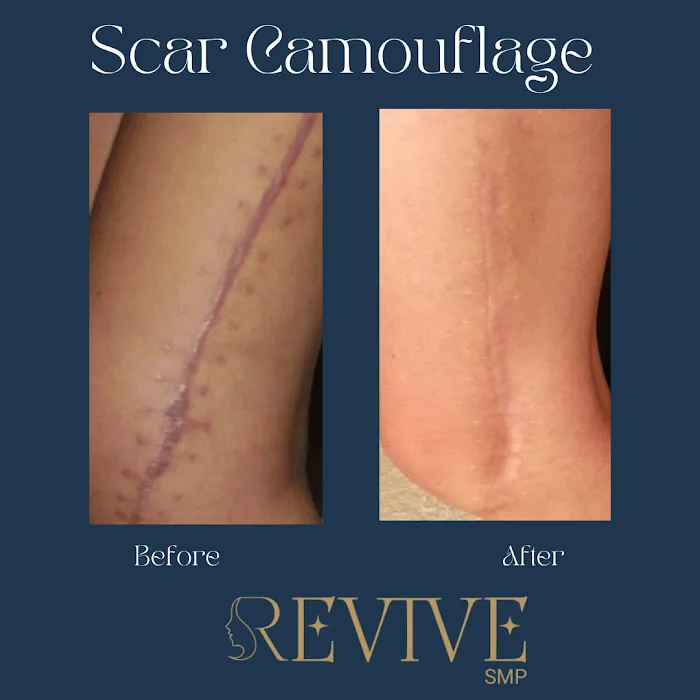 Revive SMP LLC Picture 9