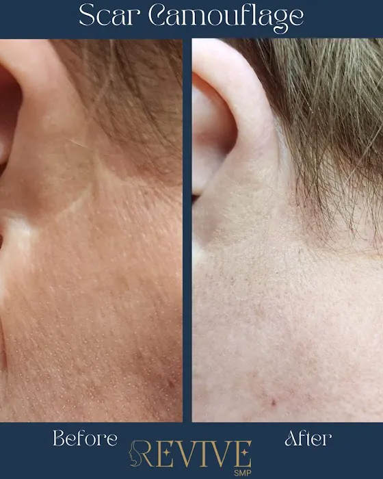 Revive SMP LLC Picture 8