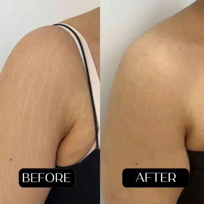 Revive SMP LLC Picture 7