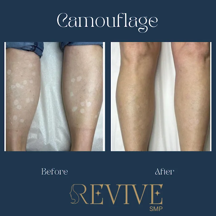 Revive SMP LLC Picture 10