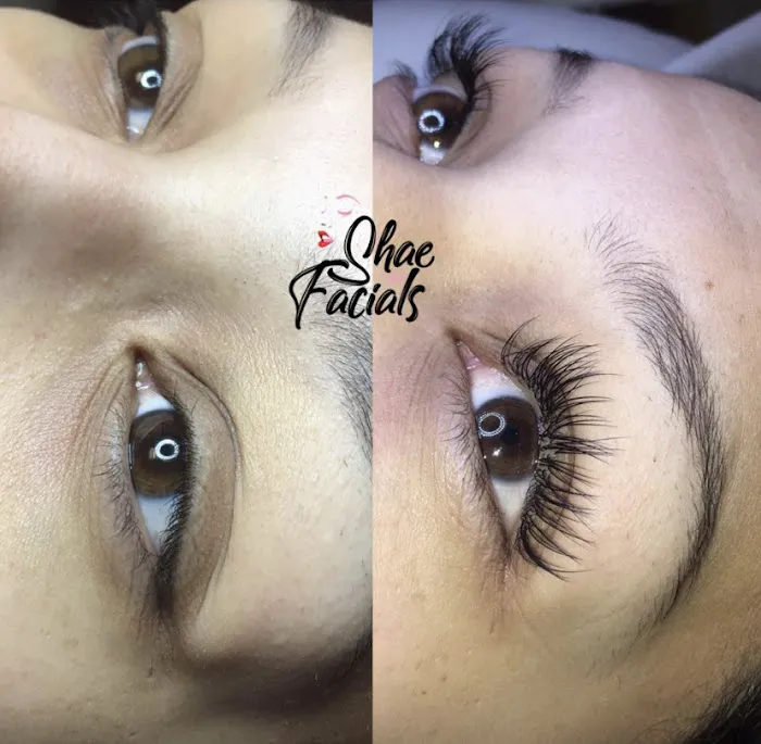 Shae for Facials Picture 6