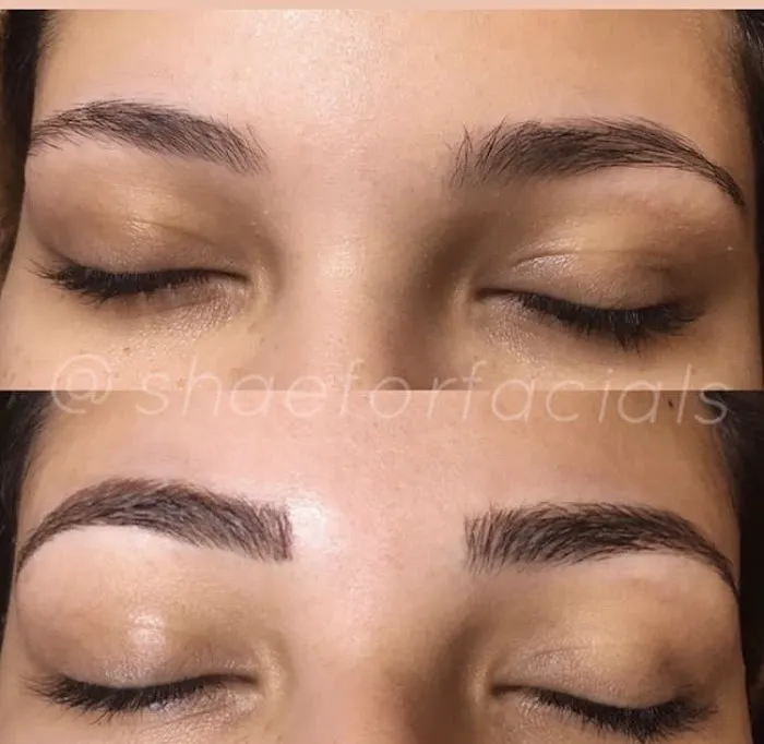 Shae for Facials Picture 7