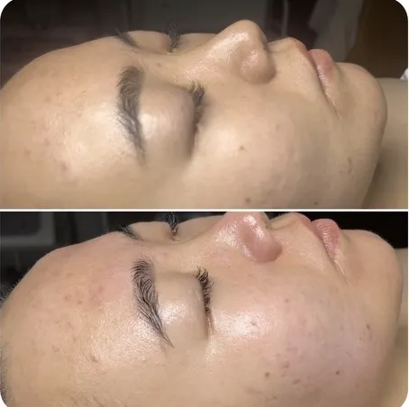 Angelina Skincare Picture 7