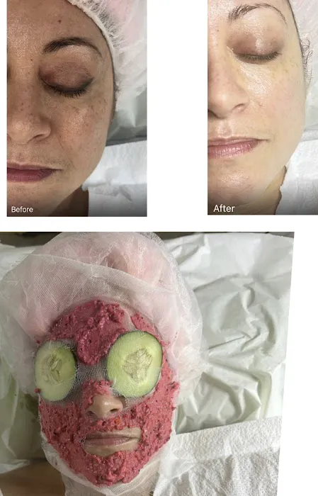 @LVtheEsthetician Picture 4