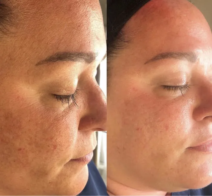 Pandora skin studio by naghmeh Picture 9