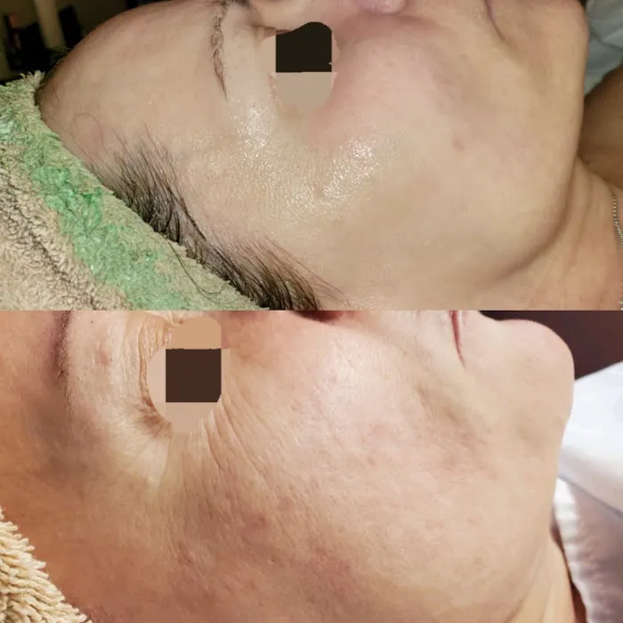 Pandora skin studio by naghmeh Picture 8