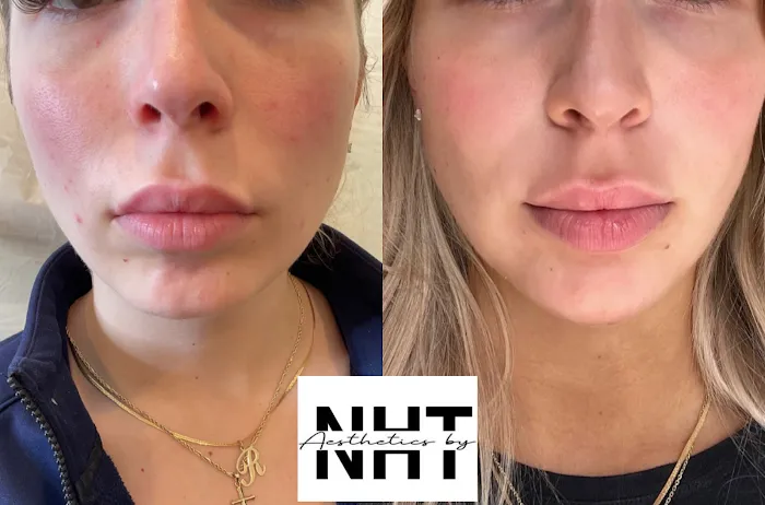 Aesthetics by NHT Picture 6