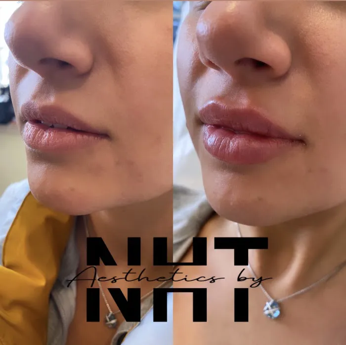 Aesthetics by NHT Picture 1