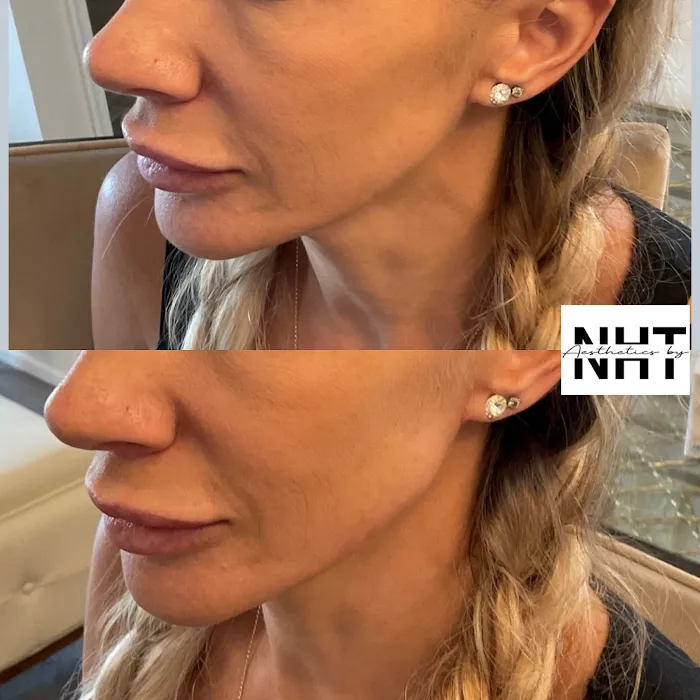 Aesthetics by NHT Picture 8