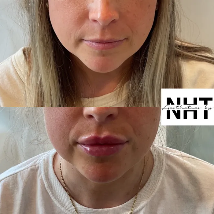 Aesthetics by NHT Picture 7