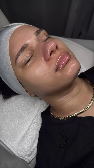 Gap.Ne Hair & Skin Clinic Picture 10