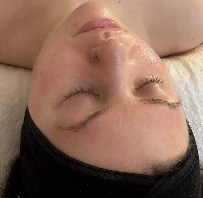 Amy Rose Aesthetics Picture 2