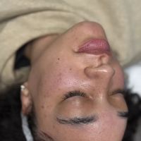 Mochi Aesthetics Clinic: Botox, PRF EzGel, Microneedling, Hydrafacial, CoolPeel ico