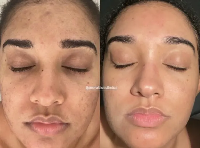 Emerald Isle Esthetics Picture 2