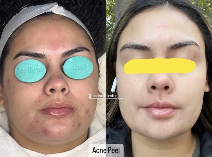 Emerald Isle Esthetics Picture 6