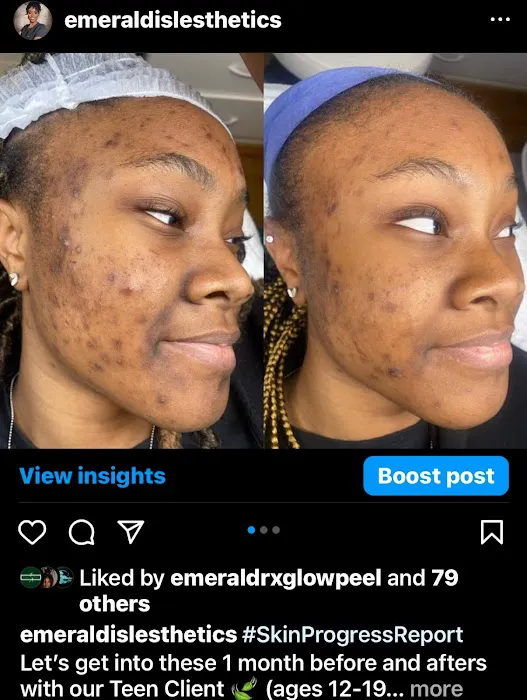 Emerald Isle Esthetics Picture 7