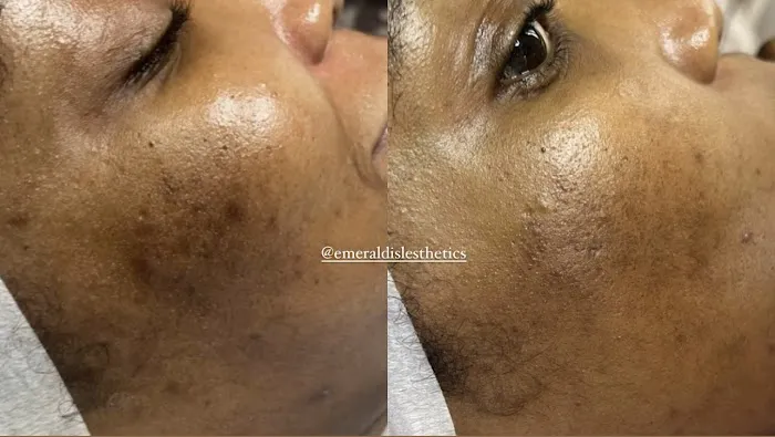 Emerald Isle Esthetics Picture 8