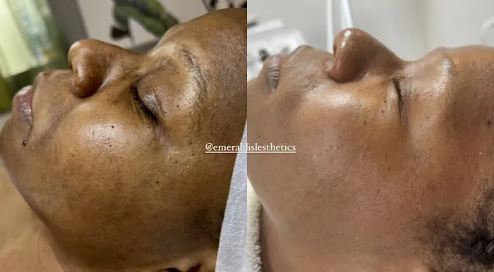 Emerald Isle Esthetics Picture 5