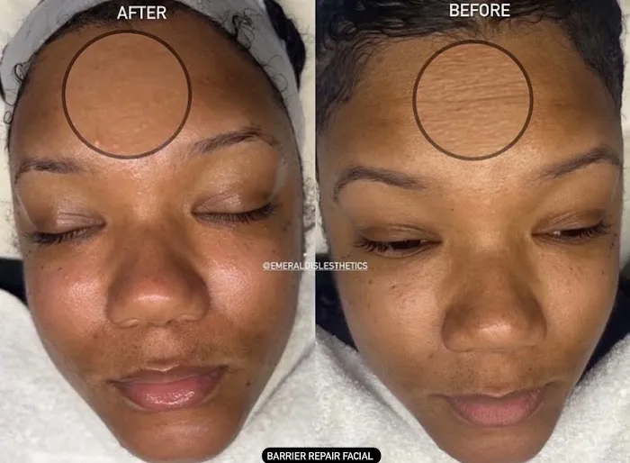 Emerald Isle Esthetics Picture 9