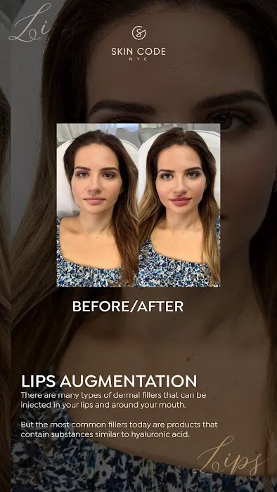 Skin Code NYC - Manhattan Picture 9