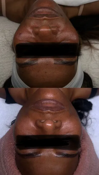 Beauty N Komplexion | Belleville NJ Facials & Corrective Skin Care Picture 5