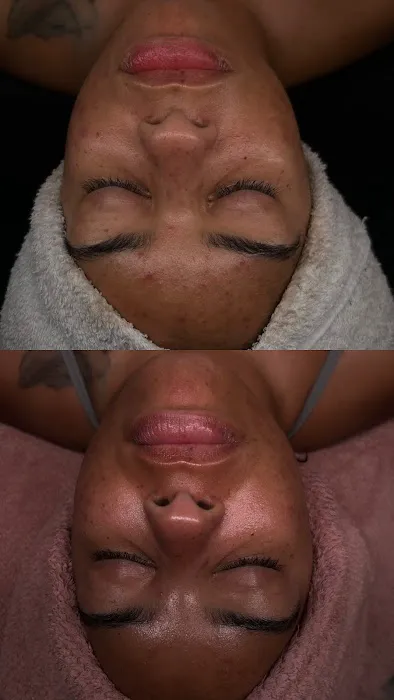 Beauty N Komplexion | Belleville NJ Facials & Corrective Skin Care Picture 10