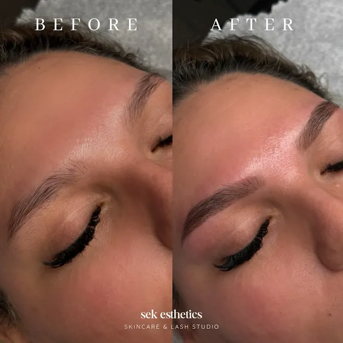 SEK Esthetics Picture 8