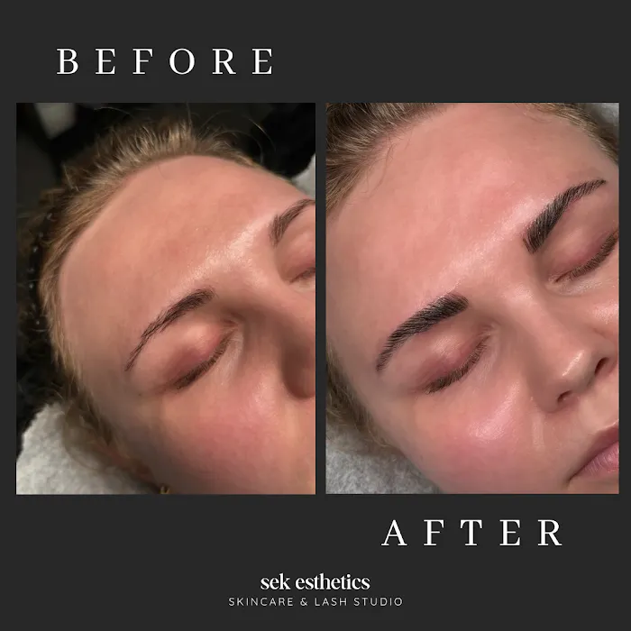 SEK Esthetics Picture 10