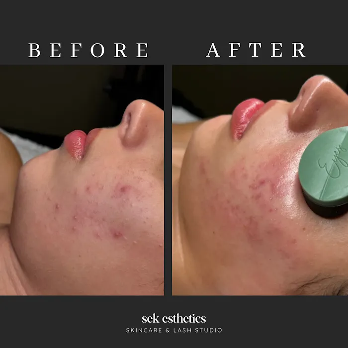 SEK Esthetics Picture 9