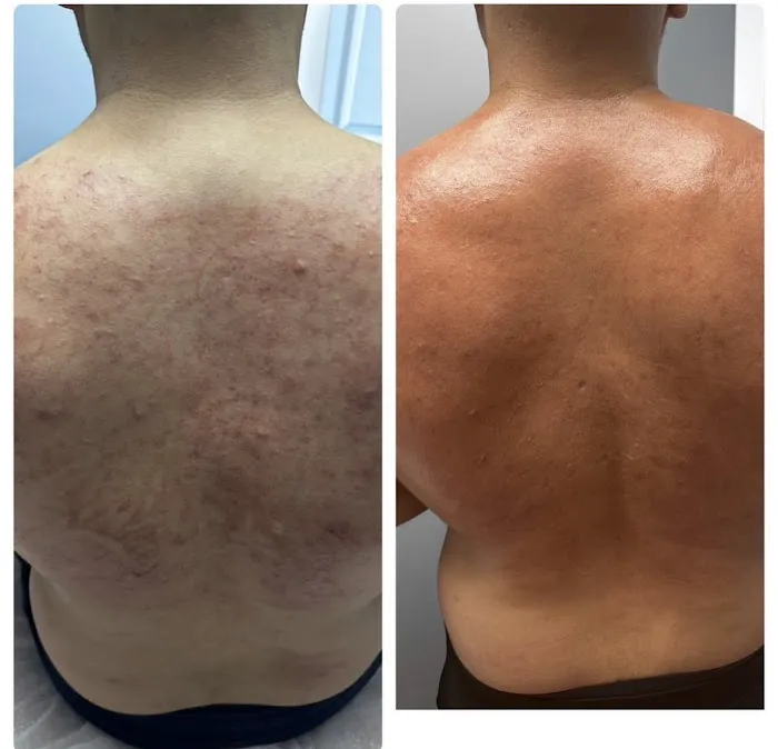 Just in time beauty spa Picture 6