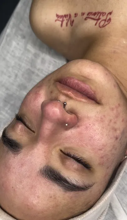 Mingg Esthetics Picture 4