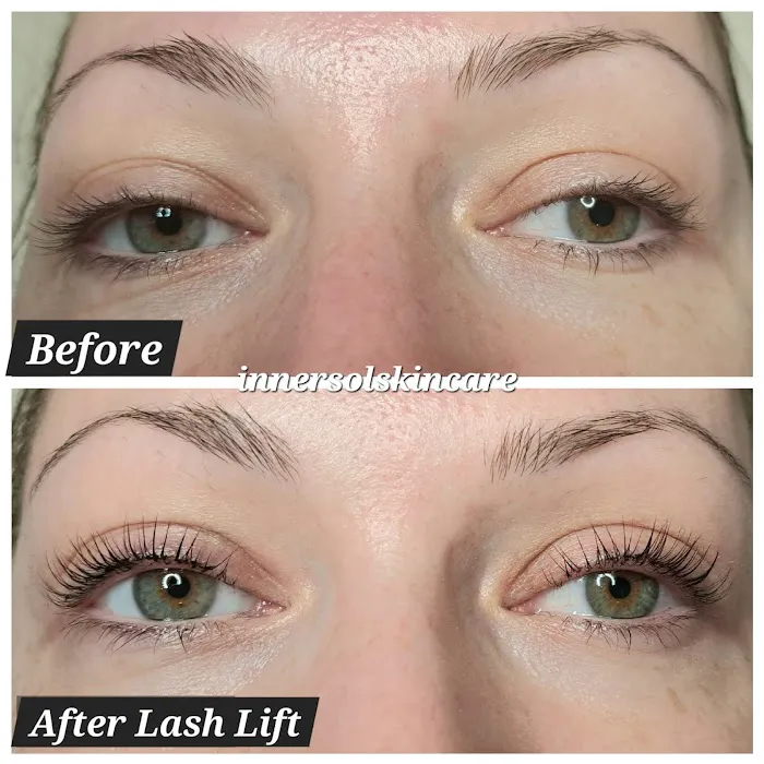 Innersol Skincare Picture 1