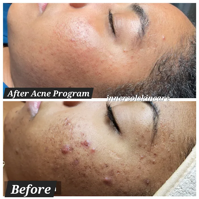 Innersol Skincare Picture 6