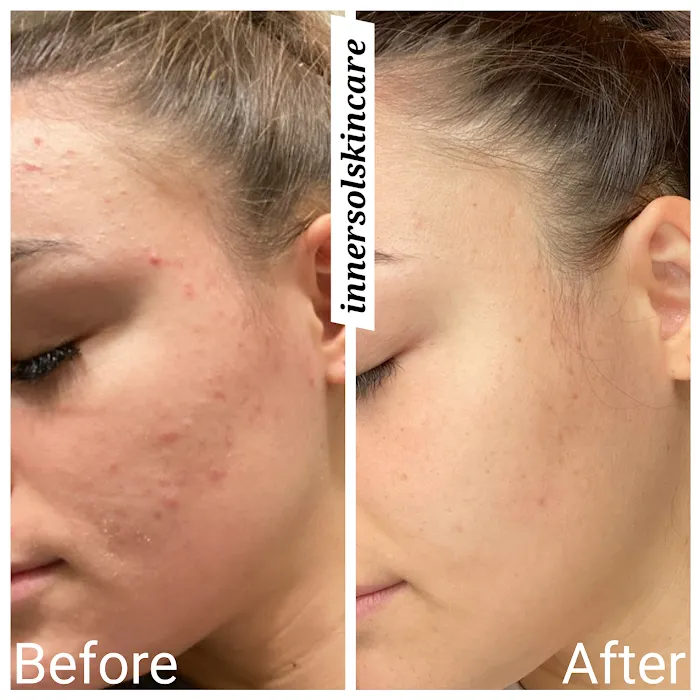 Innersol Skincare Picture 5