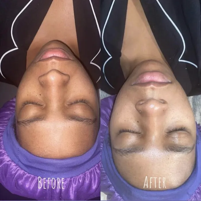 Dreyco Beauty Picture 1