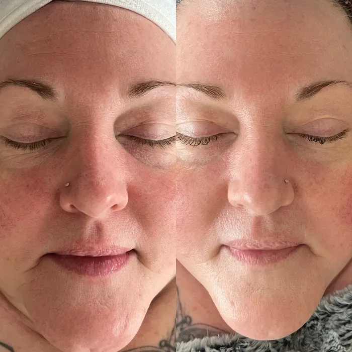 Natch - Esthetics Lounge, LLC Picture 5