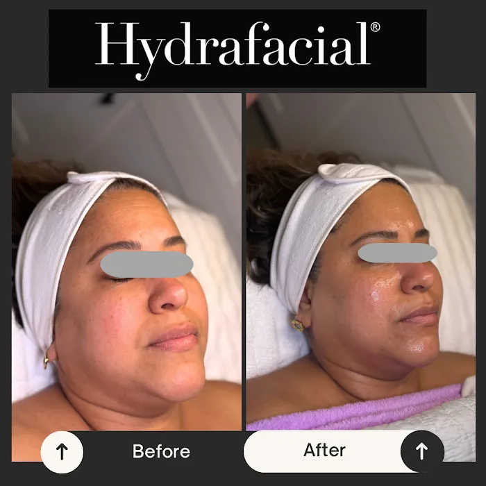 My Skin Obsession Picture 6