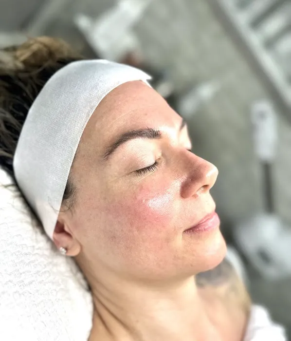 My Skin Obsession Picture 4