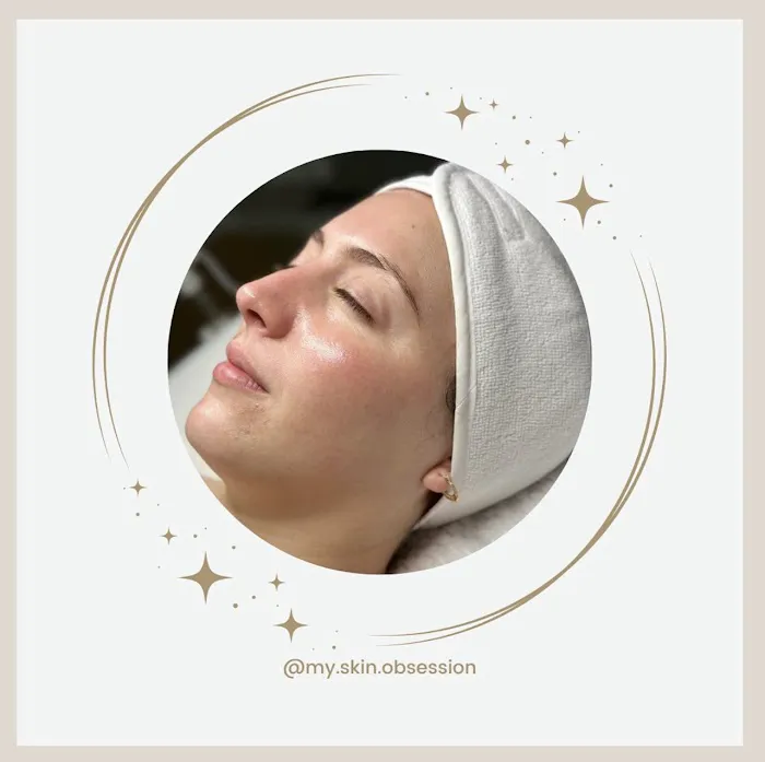 My Skin Obsession Picture 5