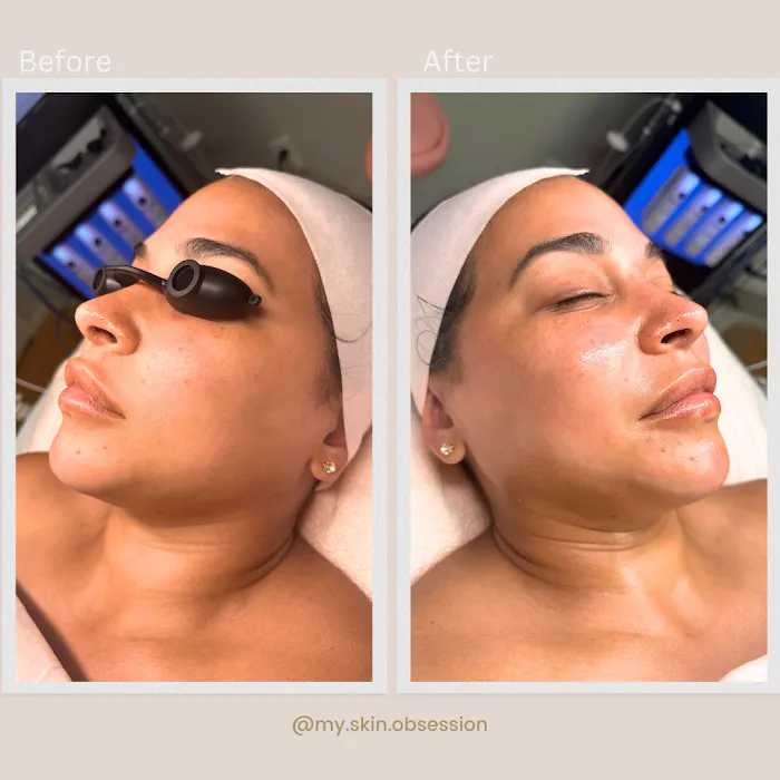 My Skin Obsession Picture 8