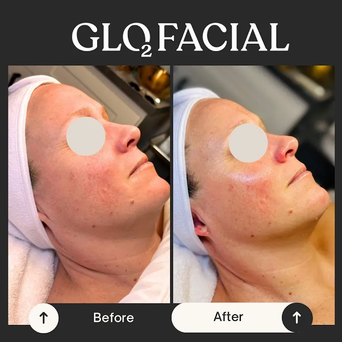 My Skin Obsession Picture 7