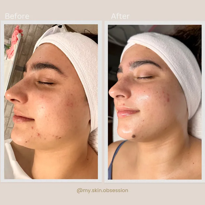 My Skin Obsession Picture 10