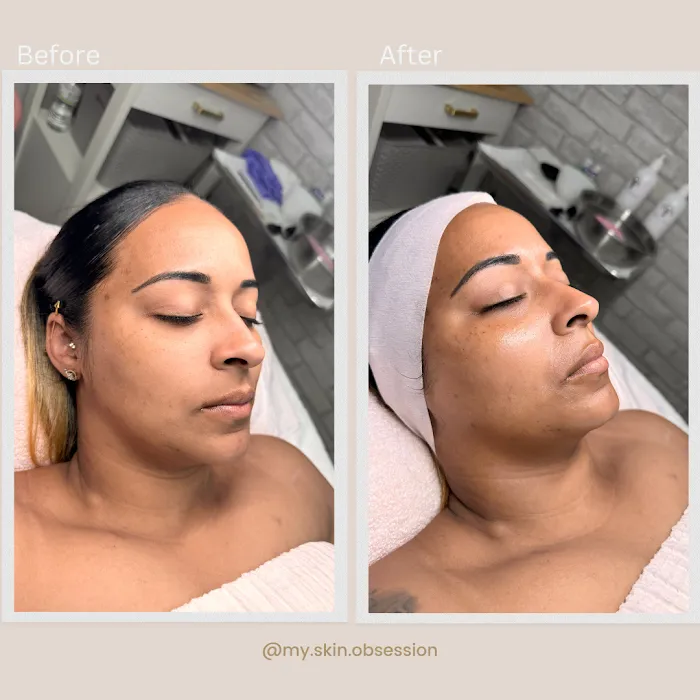 My Skin Obsession Picture 9